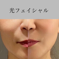 画像357